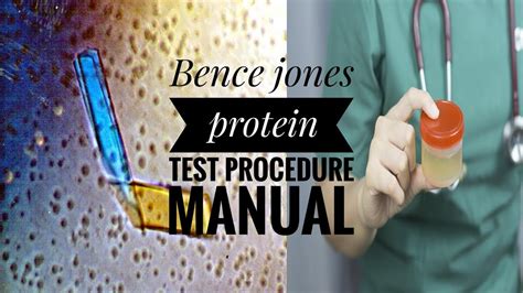 bence jones protein test bottle|bence jones protein symptom checker.